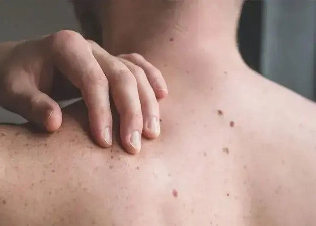 Skin Issues?